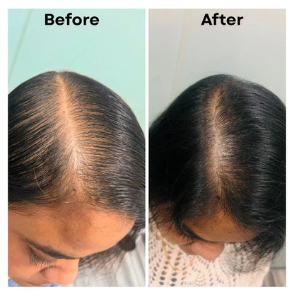 Hair Growth Bundle & Frizz Control Solution