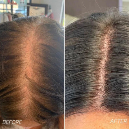 Hair Growth Bundle & Frizz Control Solution