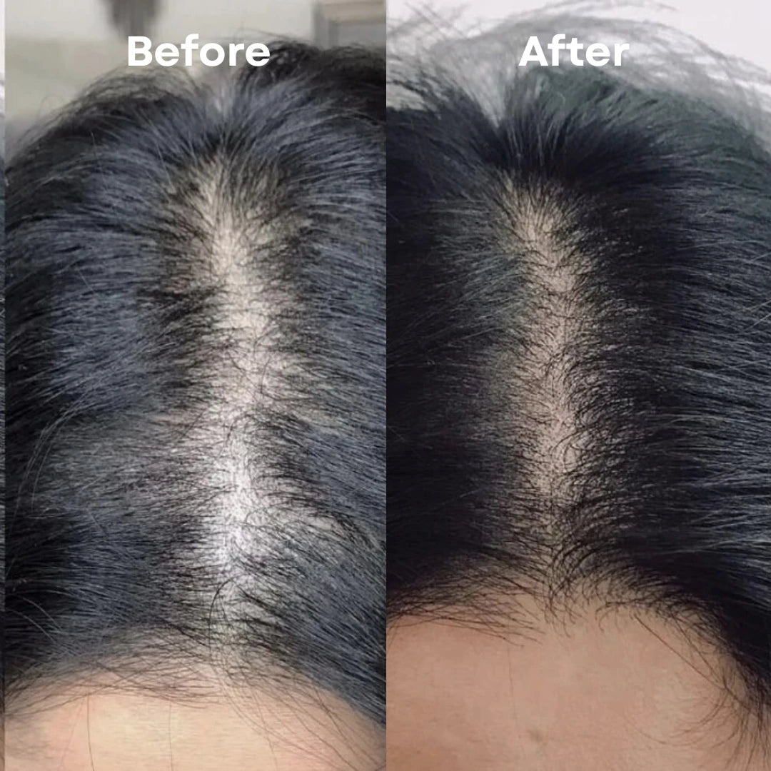 Hair Growth Bundle & Frizz Control Solution