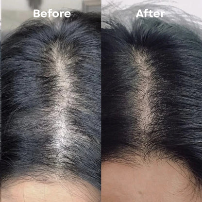 Hair Growth Bundle & Frizz Control Solution