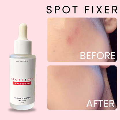 Acne Buster Serum