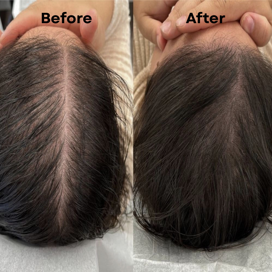 Hair Growth Bundle & Frizz Control Solution